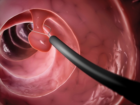 Advanced Endoscopy Services in Whitefield